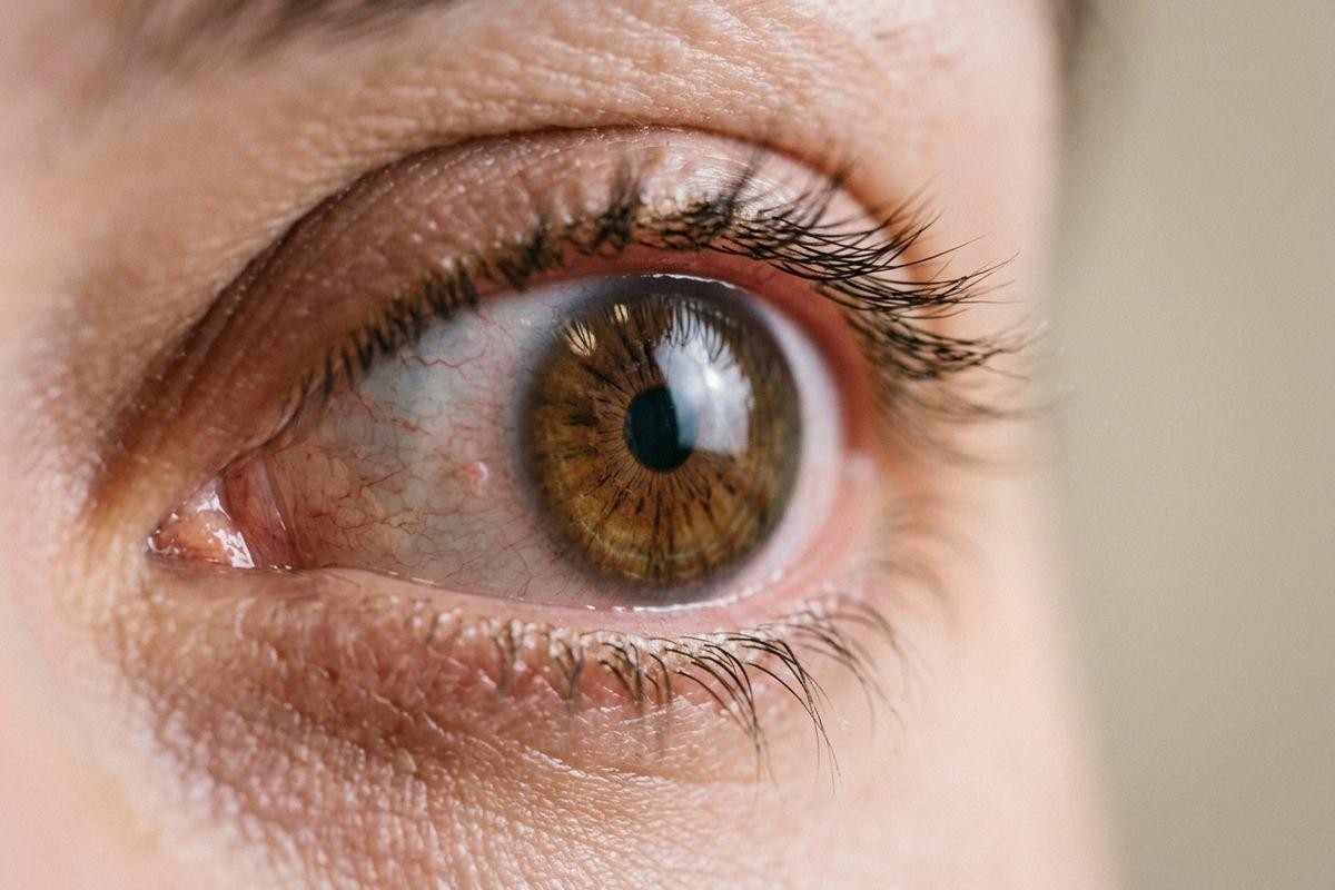 close-up-of-a-human-eye-with-a-brown-iris-dark-lashes-and-visible-blood-vessels- Close-up of a human eye with a brown iris, dark lashes, and visible blood vessels in the white of the eye.